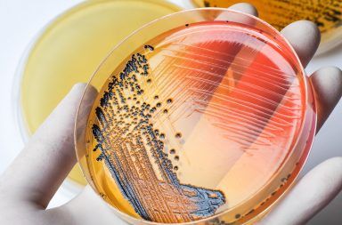 ما هو علم الأحياء الدقيقة الميكروبيولوجيا البروتينات الجينات المختبر العلوم التطبيقية اكتشاف البنسلين البكتيريا محاربة الأمراض
