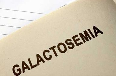 ما هي الغالاكتوزيميا؟ كيف تؤثر هذه الحالة في الطفل؟ كيف تؤثر الغالاكتوزيميا في البالغين؟ من تصيب الغالاكتوزيميا؟ وما مدى شيوعها؟
