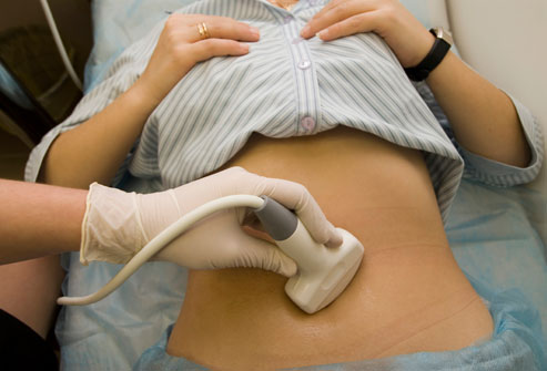 ألم الحوض عند النساء: الأسباب والعلاج - التهاب الحوض هو عدوى في الأعضاء التناسلية الأنثوية - انتباذ بطانة الرحم - عدوى منتقلة جنسيًا 