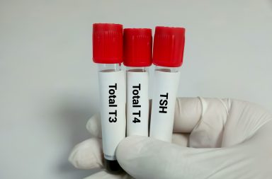 ما اختبار التيروكسين T4؟ لماذا يُطلب هذا الاختبار؟ ما الأدوية التي تؤثر في تركيز T4؟ كيف يُجرى الاختبار؟ ما المخاطر المرتبطة بإجراء الاختبار؟