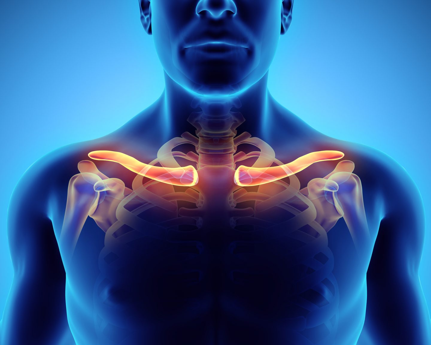 متلازمة مخرج الصدر: الأسباب والأعراض والتشخيص والعلاج