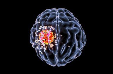 الأورام الدماغية: الأسباب والأعراض والتشخيص والعلاج علاج أورام الدماغ أسسباب ظهور الورم داخل القحف الطفرات الجينية التي تسبب السرطان