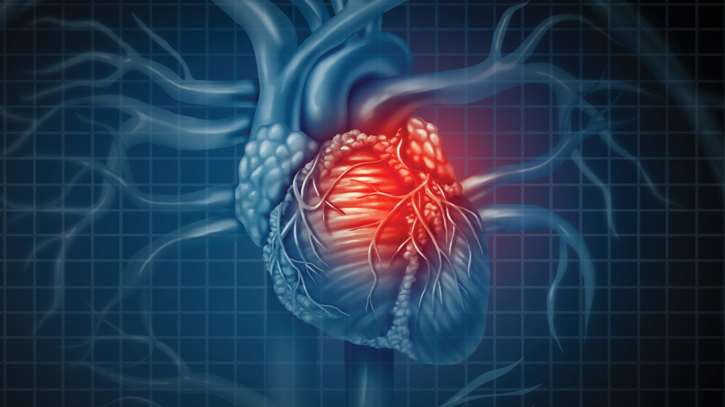 عيوب القلب الخلقية: الأسباب والعلاج