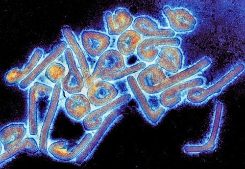 Twelve most dangerous viruses on earth - Winning battle against viruses - Hantaviruses - Smallpox - Marburg virus - Ebola - SARS-Cove-2