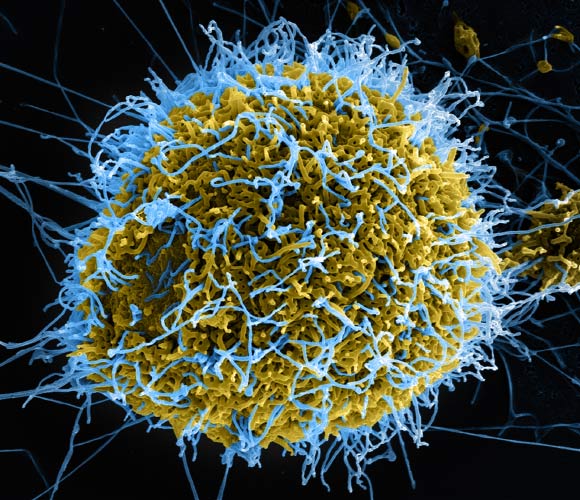 دراسة كبيرة: الفيروسات لها تأثير هائل على التطور البشري
