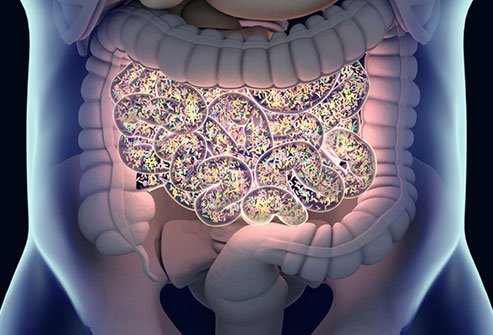 فرط النمو البكتيري في الأمعاء الدقيقة: كل ما تحتاج إلى معرفته