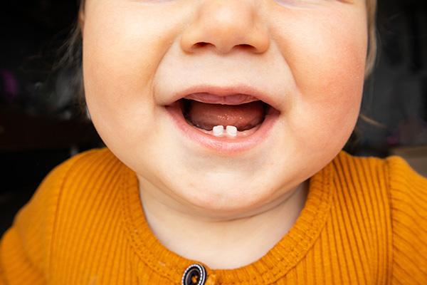 كيف يمكن الاعتناء بأسنان الرضيع؟