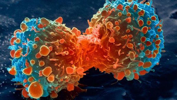 سبعة أشياء غريبة تزيد من خطر الإصابة بالسرطان