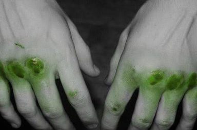 في ظروف معينة يمكن أن يختلف لون دمك حسب الوسط الذي تراه فيه. لماذا يبدو لون الدم أخضر في قاع المحيطات والبحار؟ لون الدم الأخضر