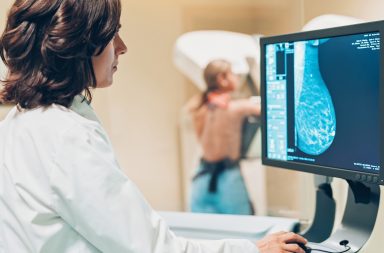 الذكاء الاصطناعي يتفوق على البشر في تشخيص سرطان الثدي - الفحص الدوري هو الطريقة الأفضل للكشف عن العلامات المبكرة للسرطان - اكتشاف السرطان