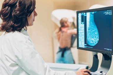 الذكاء الاصطناعي يتفوق على الأطباء في تشخيص سرطان الثدي! - صور الأشعة للكشف عن سرطان الثدي - الفحوصات المنتظمة والتشخيص الدقيق للسرطان
