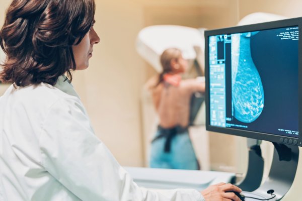 الذكاء الاصطناعي يتفوق على الأطباء في تشخيص سرطان الثدي!