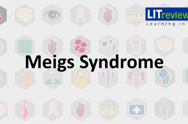 متلازمة ميغز: الأسباب والأعراض والتشخيص والعلاج - أورام المبيض الليفية هي أكثر الأورام الحميدة التي تظهر في متلازمة ميغز - الاستبعاد في التشخيص