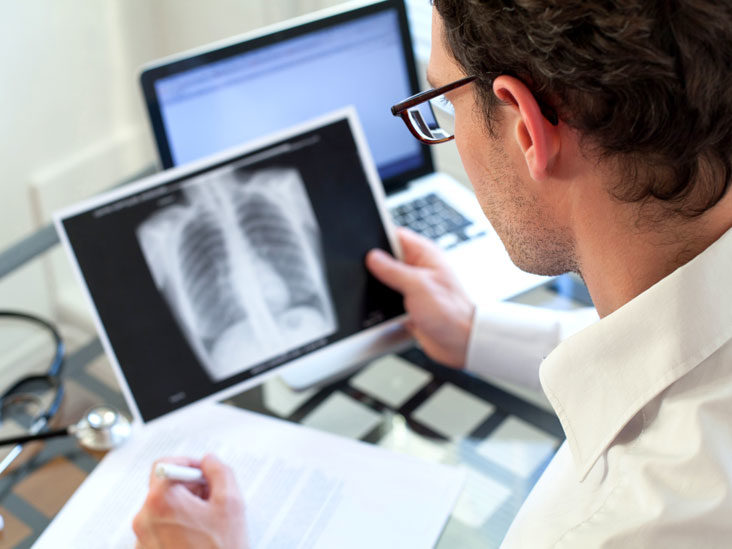 داء الرئة بالمتفطرة الطيرية: الأسباب والأعراض والتشخيص والعلاج