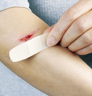 تنظيف الجروح خطوة بخطوة - إليك كيف تقوم بتنظيف الجروح في خمس خطوات سهلة - كيفية غسل الجروح؟ - كيف توقف نزيف الجروح؟ - تضميد الجروح