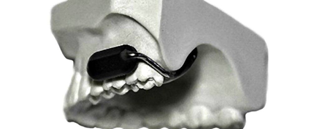 مخيف! الجيش الأمريكي يطوّر ميكرفون عالي السرية يوضع في الأسنان