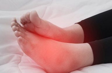 سخونة القدمين: الأسباب والعلاج - حرارة مؤلمة في القدمين إذ يؤثر الألم في النوم، وتتراوح شدة السخونة من معتدلة إلى شديدة - قدم الرياضي