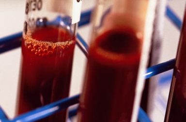 ما الذي يحدث لكريات الدم الحمراء في الفضاء؟ هل يتغير تعداد كريات الدم الحمراء لدى رواد الفضاء الذين يقضون فتراتٍ طويلةً خارج الأرض؟
