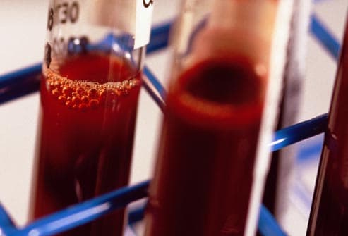 ما الذي يحدث لكريات الدم الحمراء في الفضاء؟