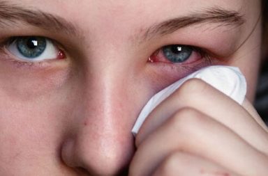 الإحساس بحكة أو حرقة - ألم العين: الأسباب والعلاج - تهيج ناتج من جسم غريب أو عدوى أو جرح - الشعور بوجود حبات رمل أو وخز أو نبضات