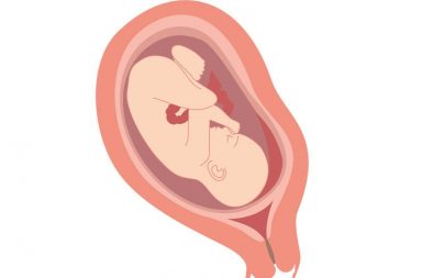 نزول المشيمة (انزياح المشيمة): الأعراض والعلاج - عضو ينمو داخل بطانة الرحم في أثناء فترة الحمل - العضو المتصل بالحبل السري