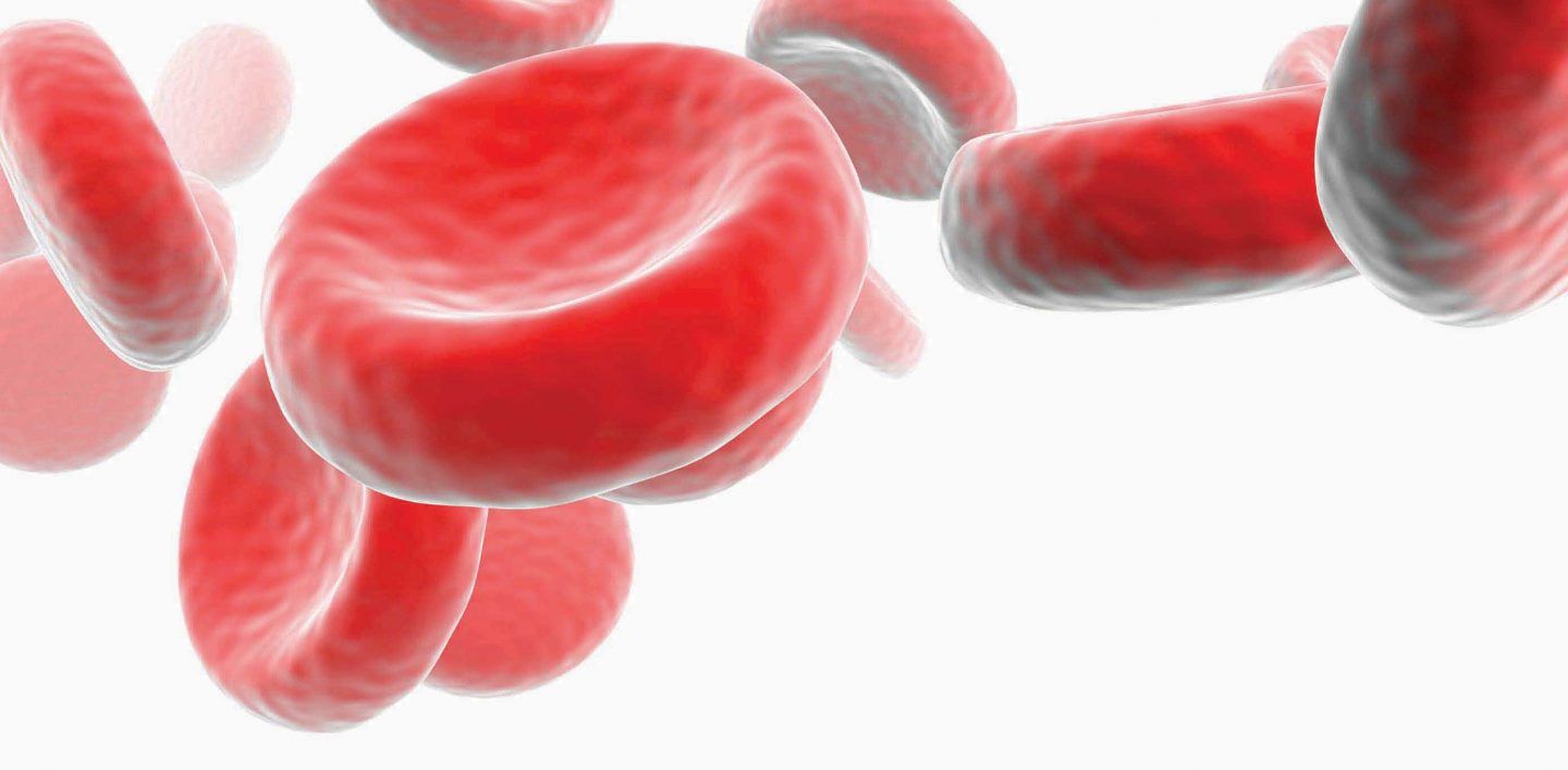 كيف تتفادى فقر الدم (الأنيميا) وترفع من عدد كريات دمك الحمراء؟