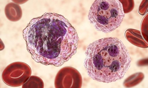 نهج جديد لعلاج اللوكيميا (سرطان الدم)