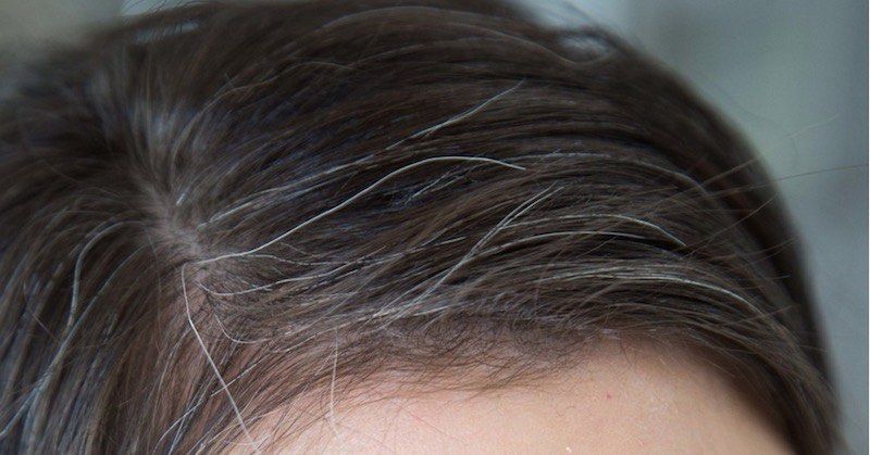 هل يؤدي اقتلاع الشعر الرمادي (الأبيض) إلى نمو المزيد منه؟