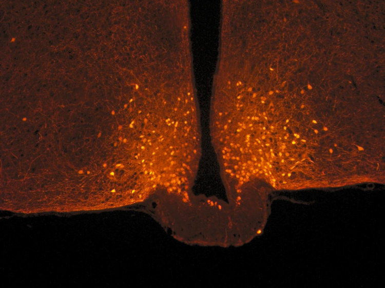 صورة لعصبونات POMC (النقاط البرتقالية) في منطقة تحت المهاد بدماغ الفأر