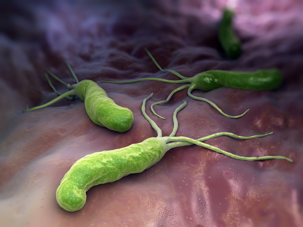 كيف تصمد البكتريا الملوية البوابية المسببة لعدوى و قرحة المعدة في بيئة المعدة الحامضية ؟