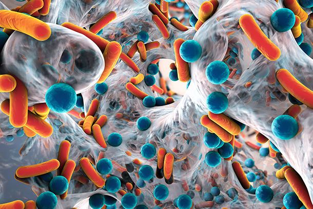 التهاب اللفافة الناخر Necrotizing Soft Tissue Infections أنا أصدق العلم