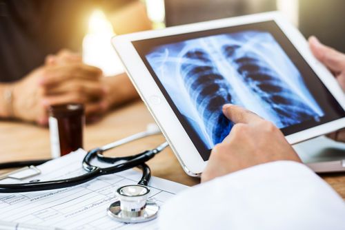 التهاب الأوعية المجهري Microscopic Polyangiitis