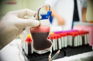 تفاعلات نقل الدم: الأعراض والمضاعفات والعلاج - ما هي التفاعلات التي يمكن أن تحدث عند نقل الدم بين شخص وآخر - مخاطر التبرع بالدم