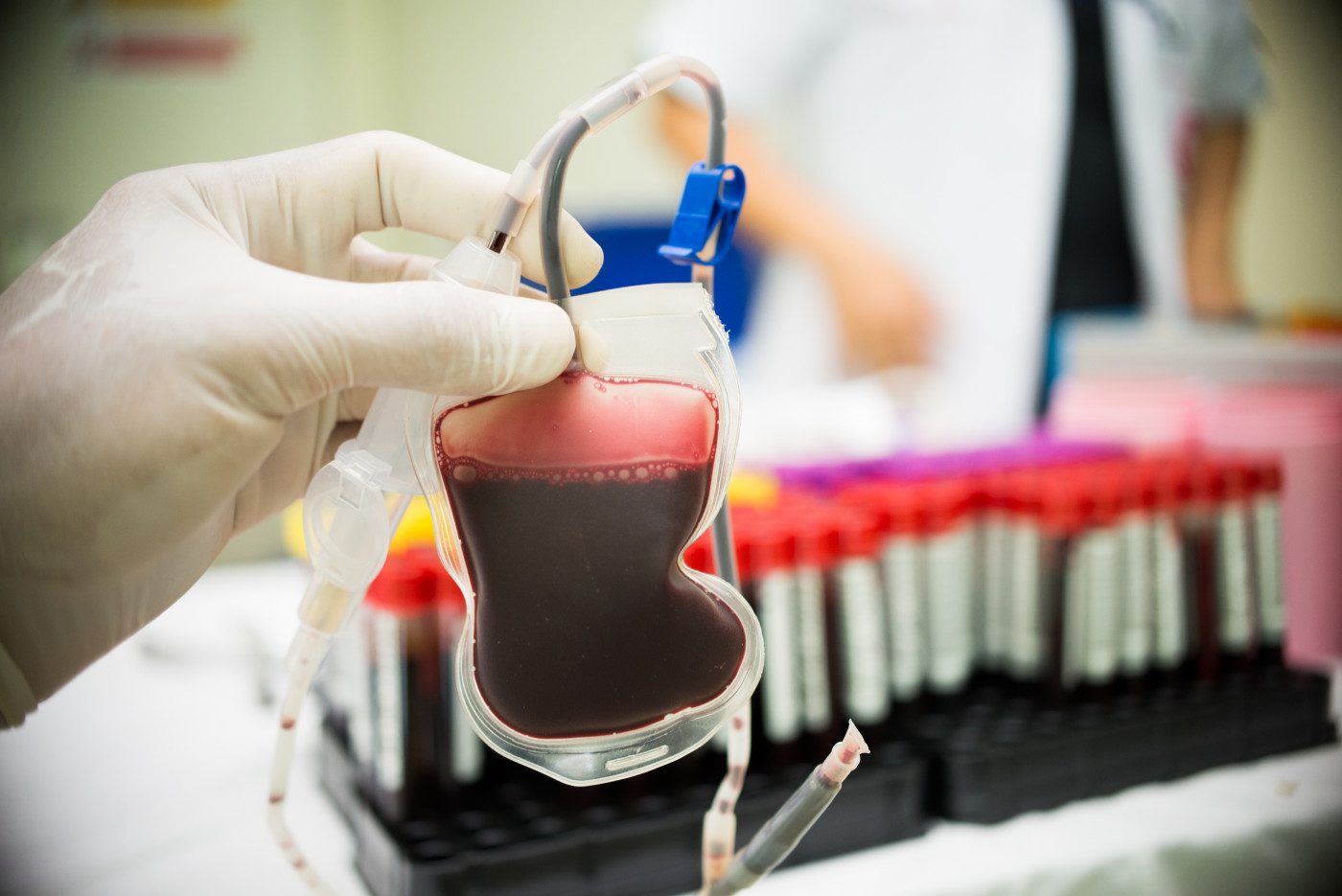 تفاعلات نقل الدم: الأعراض والمضاعفات والعلاج