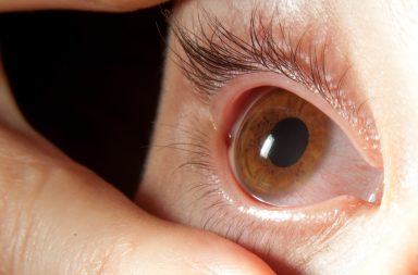 تتسم الغلوكوما بفقدان تدريجي للخلايا الحساسة للضوء في العين وبتلف العصب البصري. تقترح دراسة جديدة أن اضطرابات النوم قد تسبب  الإصابة بالغلوكوما