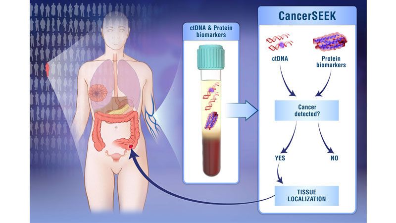 اختبار دموي واحد يكشِف عن ثمانية أنواع من السرطانات