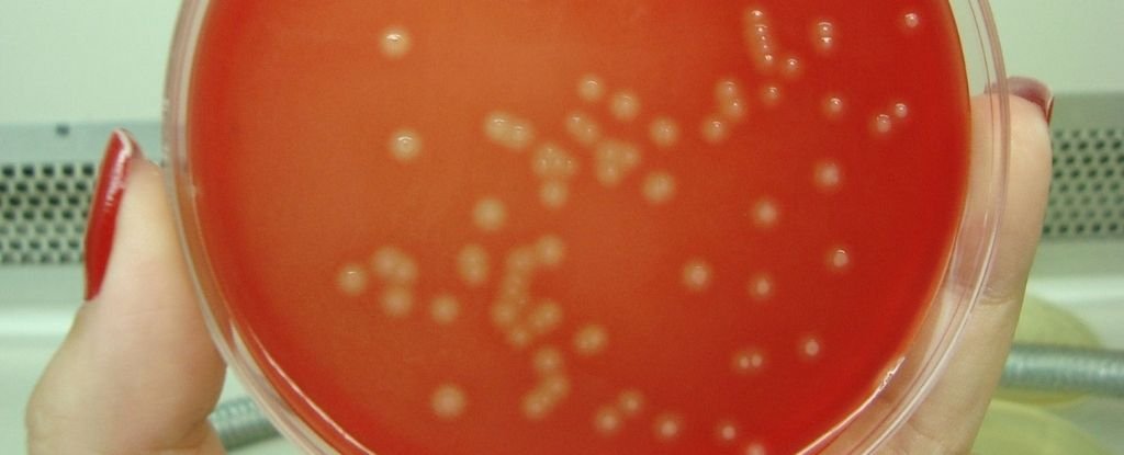بكتيريا في السبيل البولي تصنع حمضها النووي من البول - سبب لالتهاب المسالك البولية لدى بعض البشر - بكتيريا الإشريكية القولونية بكتيريا الإشريكية القولونية 