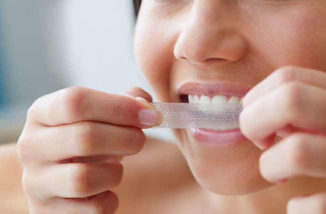 هل تبييض الأسنان إجراء آمن؟