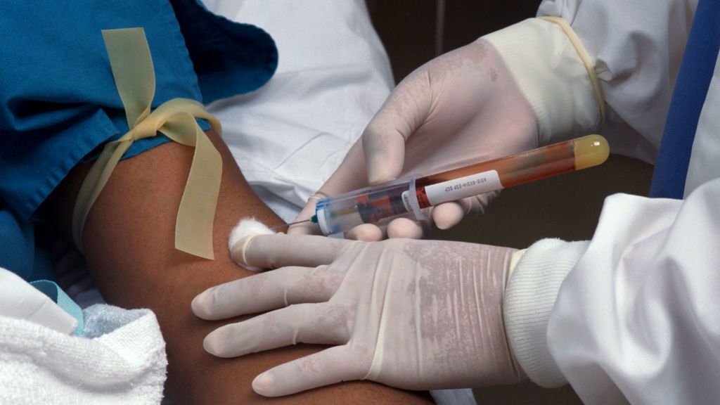 كم عليك أن تصوم قبل قيامك بتحليل الدم؟