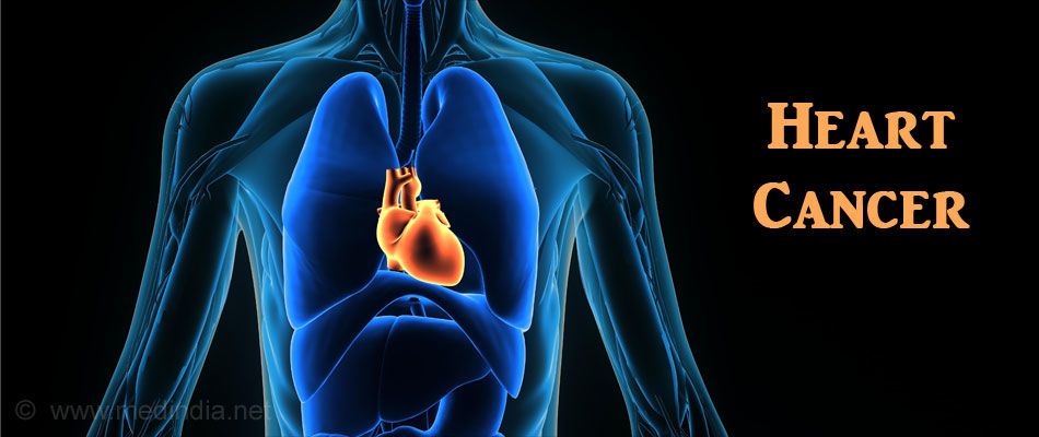 لماذا سرطان القلب مرض نادر جداً؟