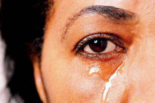 ما أسباب كثرة دمع العين وما علاجه؟ أنا أؤمن بالعلم