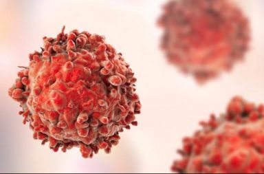 لمفوما هودجكين التعريف والأعراض والتشخيص والعلاج علاج لمفوما هودجكين خلايا الدم البيضاء الخلايا اللمفاوية سرطان الدم الجهاز اللمفاوي