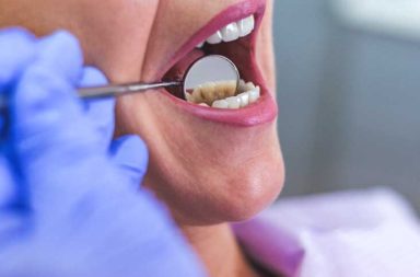 هل يمكن أن تؤدي العدوى في الأسنان إلى الوفاة؟ كم من الوقت يستغرق تطور الخراج؟ هل يمكن أن تساعد العلاجات المنزلية في علاج عدوى الأسنان؟
