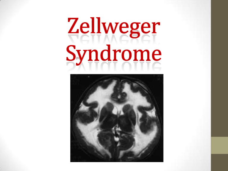 متلازمة زيلويغر: المتلازمة المخية الكبدية الكلوية