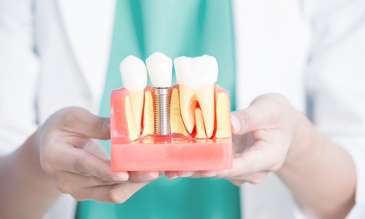 وجد العلماء طريقة لتجدد الأسنان